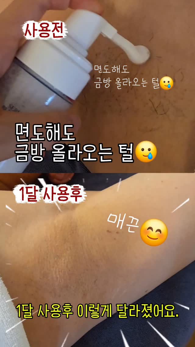 가성비 제모기